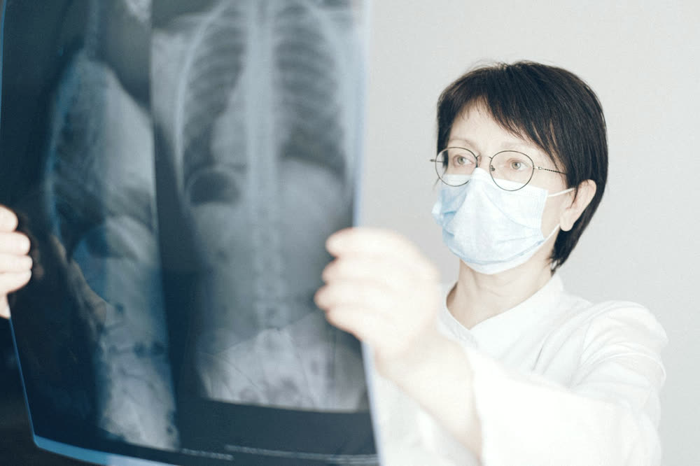 Medico che osserva una radiografia